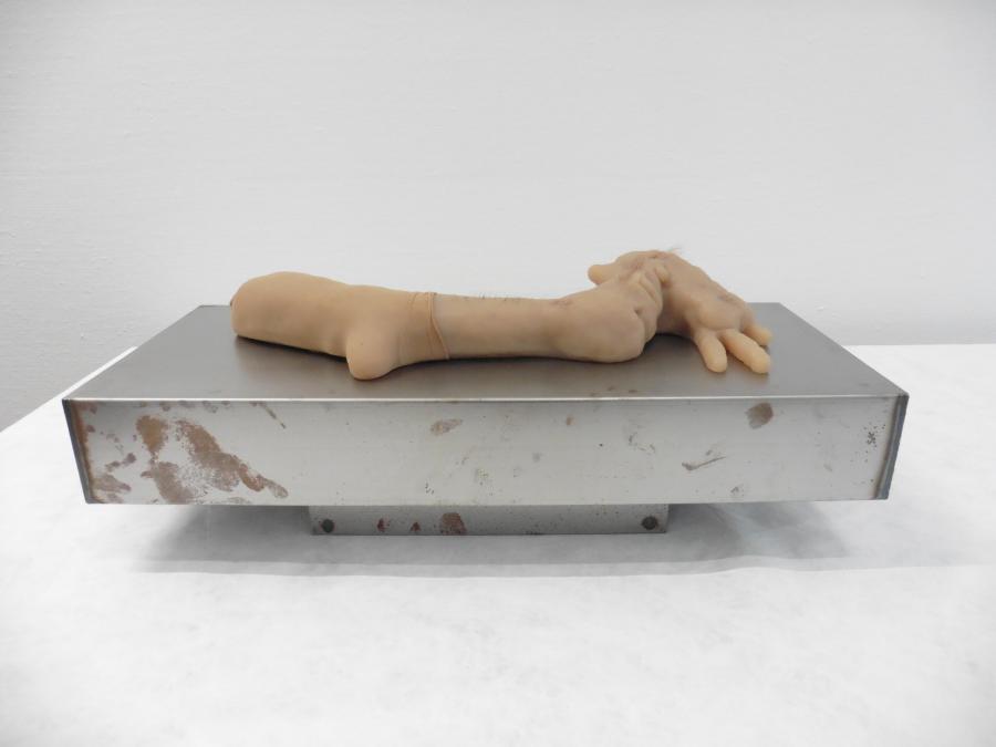 The Arm